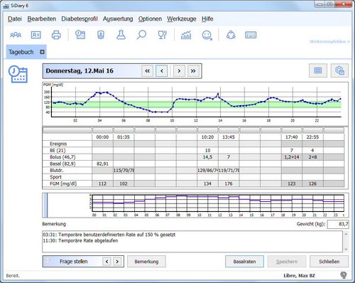 SiDiary 6.1 mit CGMS Tageskurve